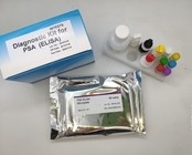 Hepatitis B Virus Core Antigen Elisa Home Test Kit 96 Pieces High Efficiency